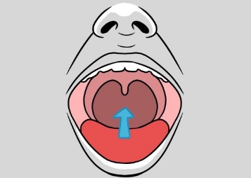 Illustration of open mouth with arrow pointing to soft palate