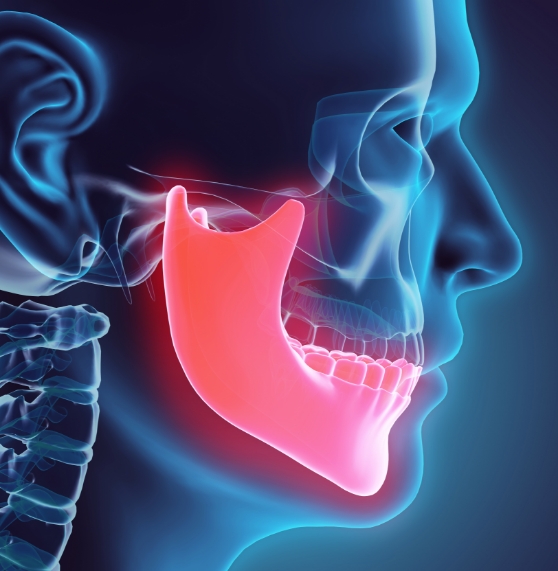 Illustrated x ray of a head with the jawbone highlighted red