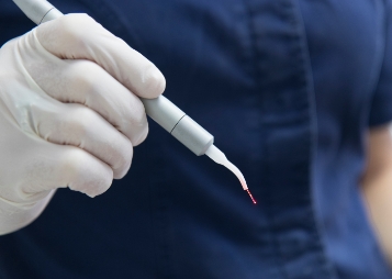 Dentist holding a pen like laser device