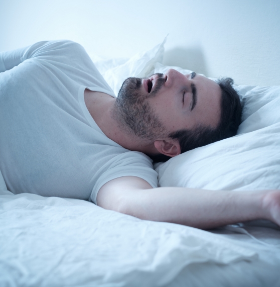 Man with sleep apnea sleeping on his back with his mouth open